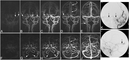 Fig 4.