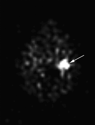 Fig 2.