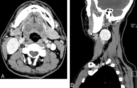 Fig 2.