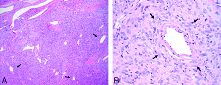 Fig 4.