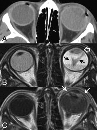 Fig 1.