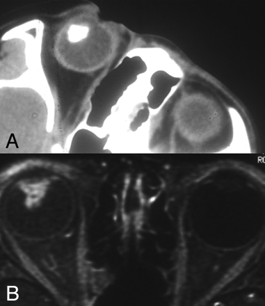 Fig 3.