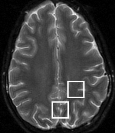 Fig 1.