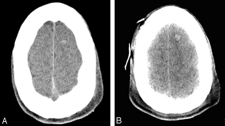 Fig 4.