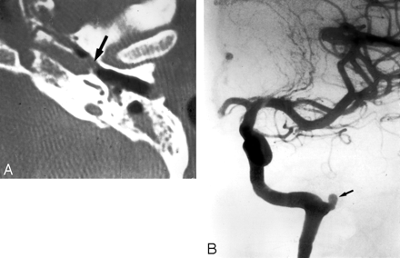 Fig 3.