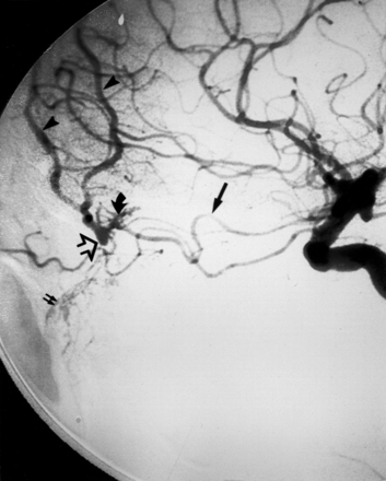 Fig 7.
