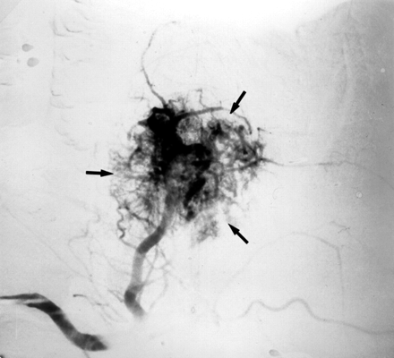 Fig 9.