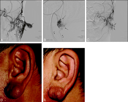 Fig 2.