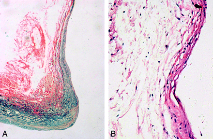 Fig 3.