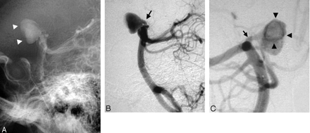 Fig 2.