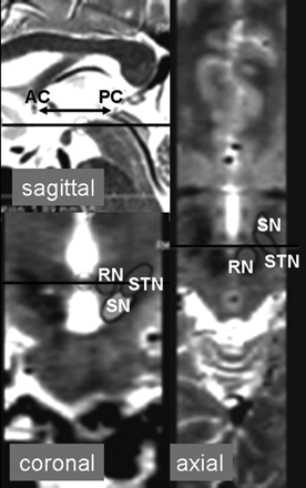 Fig 2.