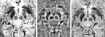Fig 3.