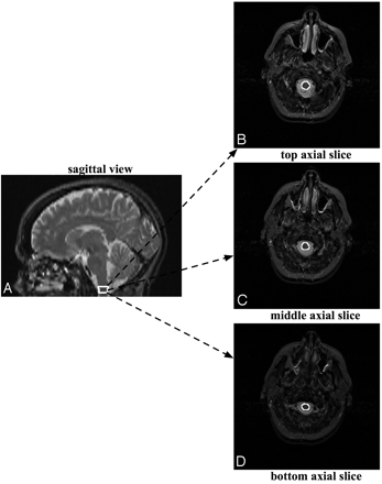Fig 1.