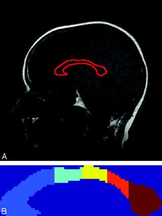 Fig 2.