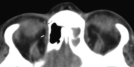 Fig 1.