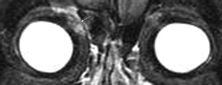 Fig 5.