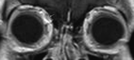 Fig 6.