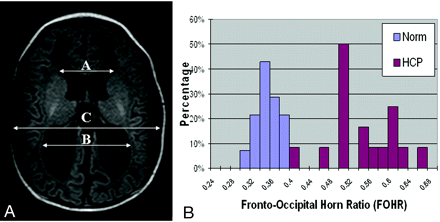 Fig 1.
