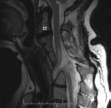 Fig 1.