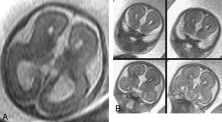 Fig 1.