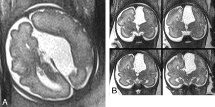 Fig 3.