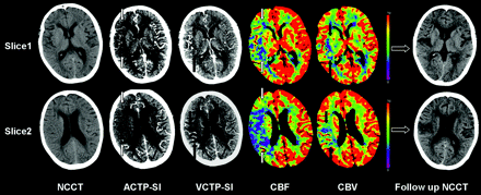 Fig 3.