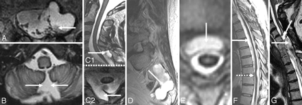 Fig 4.
