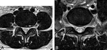 Fig 3.