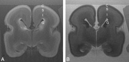 Fig 1.