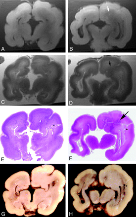 Fig 3.