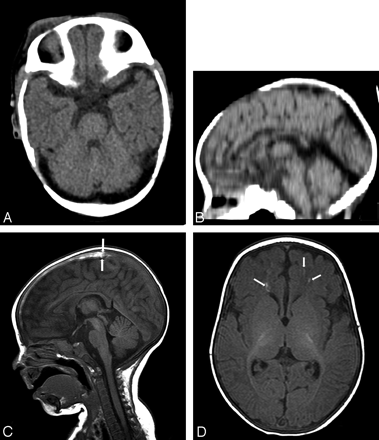 Fig 1.