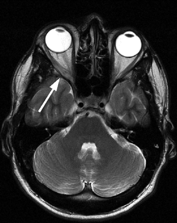 Fig 1.