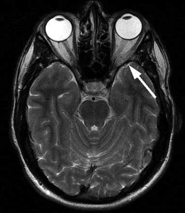 Fig 3.