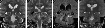 Fig 3.