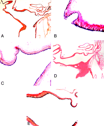 Fig 4.