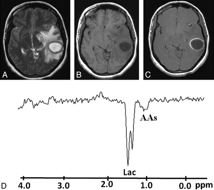 Fig 4.