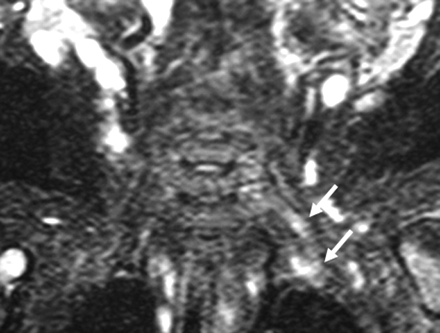 Fig 5.