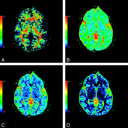 Fig 3.