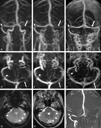 Fig 4.