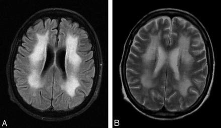 Fig 1.