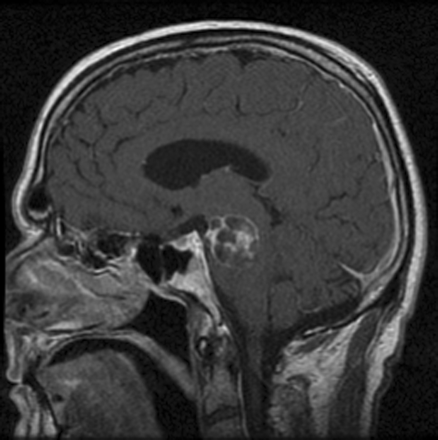 Fig 1.