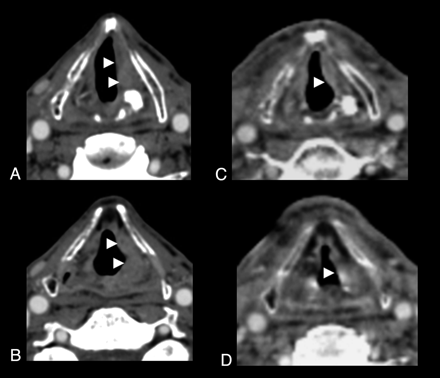 Fig 4.