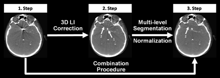 Fig 2.
