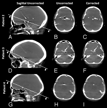 Fig 5.