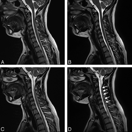 Fig 6.