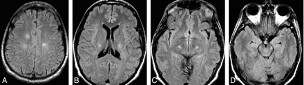 Fig 1.