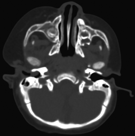 Fig 3.