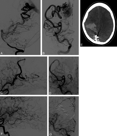 Fig 3.