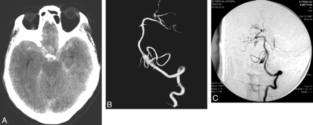 Fig 2.