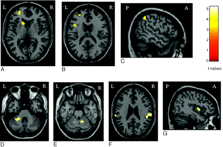 Fig 3.